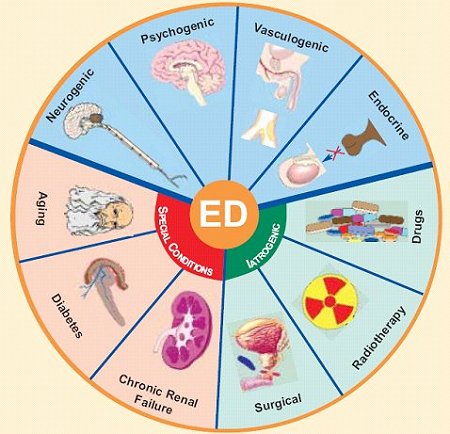 What Causes ED Erectile Dysfunction Clinic of Brentwood